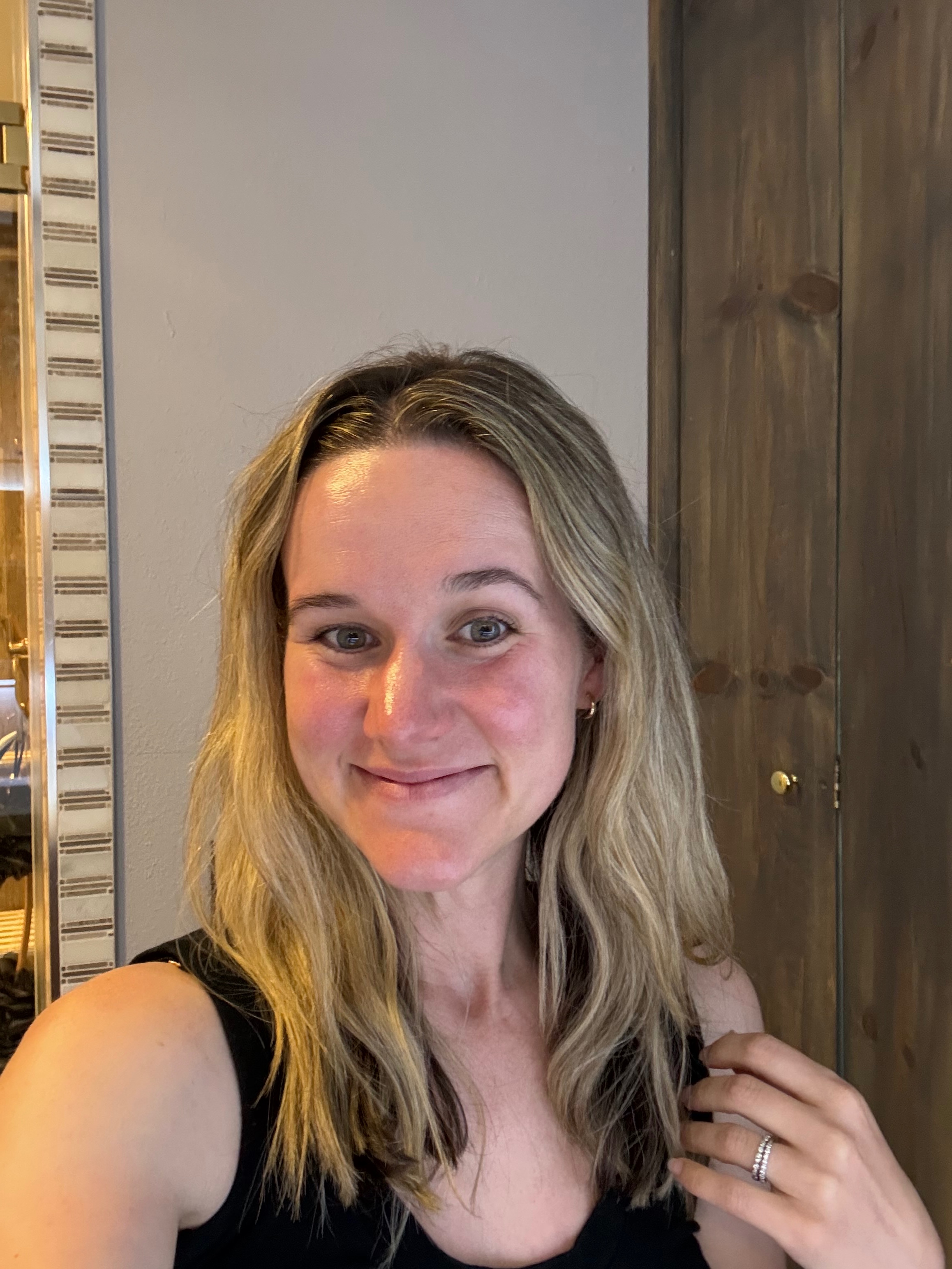 After clearing hormonal acne